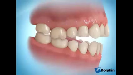 ایمپلنت ارتودنسی دکتر سهیل سالاری