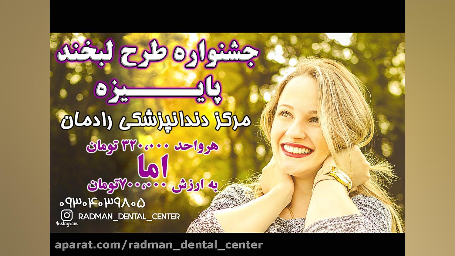 اصلاح طرح لبخند در کرج MRCP