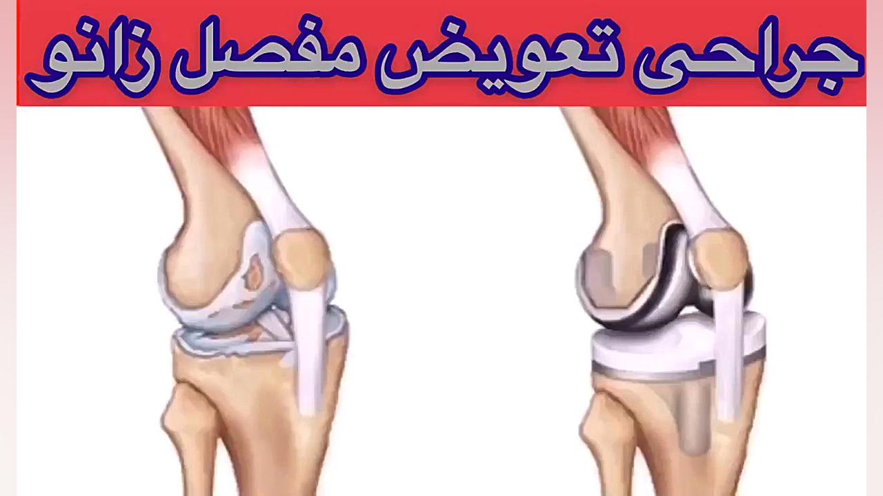 جراحی زانو09122655648متخصص طب فیزیکی،ارتوپدی،فیزیوتراپی در تهران کلینیک زیبایی