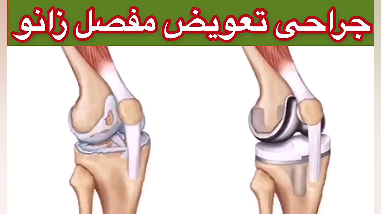 جراحی زانو09122655648متخصص طب فیزیکی و توانبخشی،فیزیوتراپی،ارتوپدی تهران لیزر مو