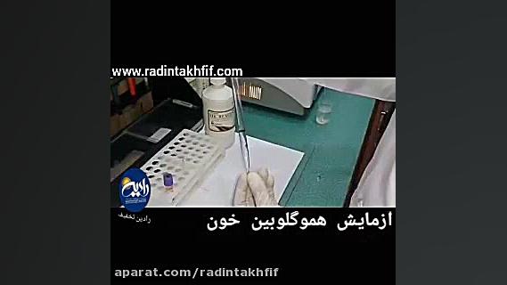 آزمایش هموگلوبین خون کلونیک اسپاسم