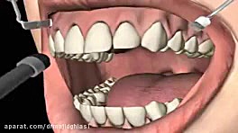 سفیدکردن دندان-دکترمجیدقیاسی دکترمجیدقیاسی