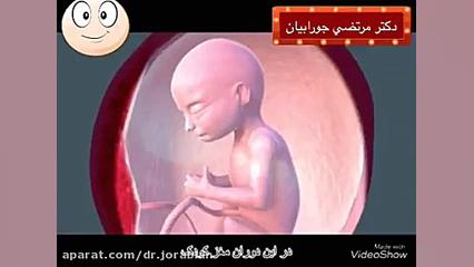 سونوگرافی جنین خرس پانداویچ