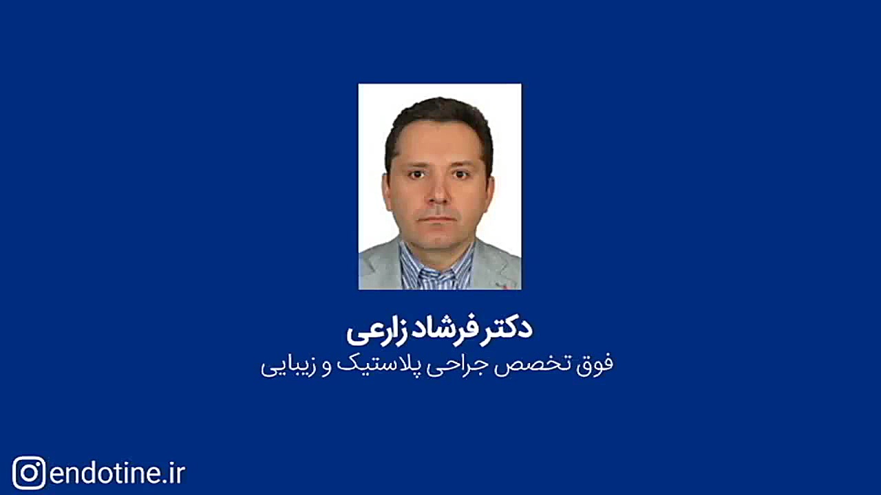 پیکرتراشی با دستگاه آمریکایی پال - لیپوساکشنی متفاوت در ایران آنجلینا جولی