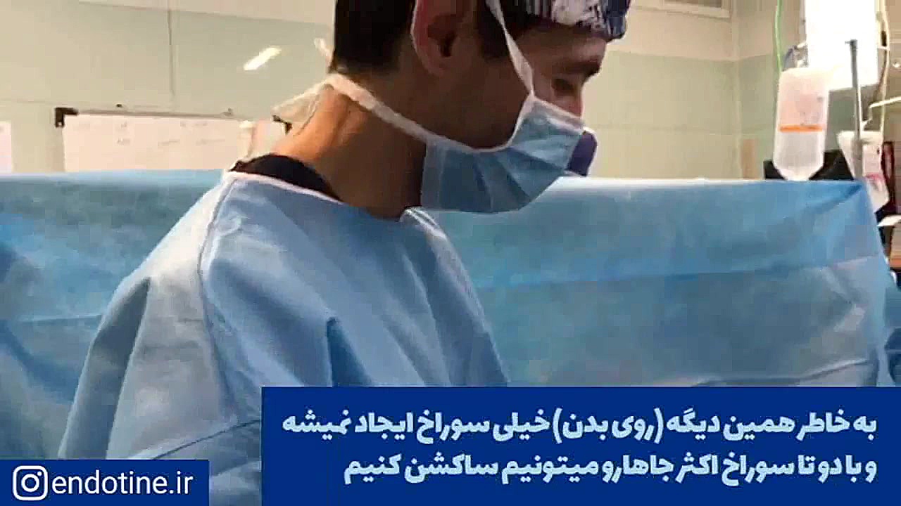 پیکرتراشی با دستگاه آمریکایی پال - لیپوساکشنی متفاوت در ایران دریک