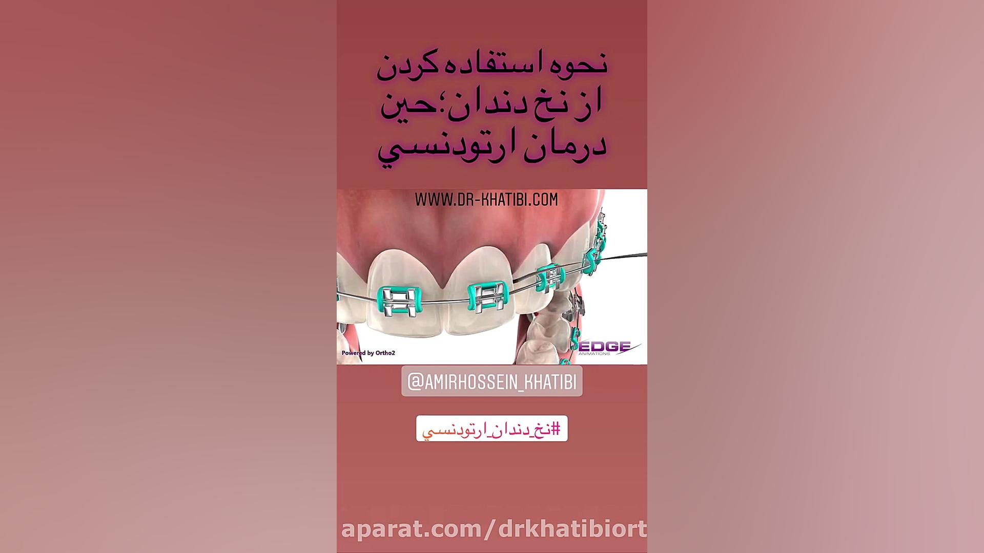 ارتودنسي دکتر امیرحسین خطیبی