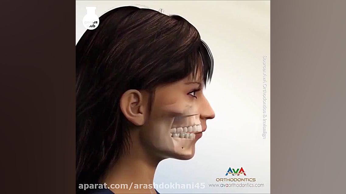 جراحی فک دکتر آرش دخانی