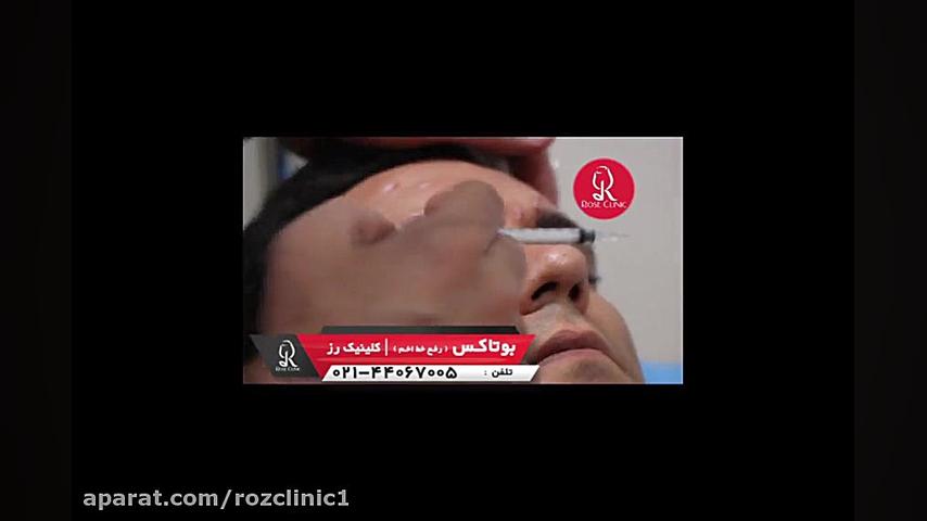 تزریق بوتاکس | فیلم تزریق بوتاکس | کلینیک پوست و مو رز کلینیک زیبایی