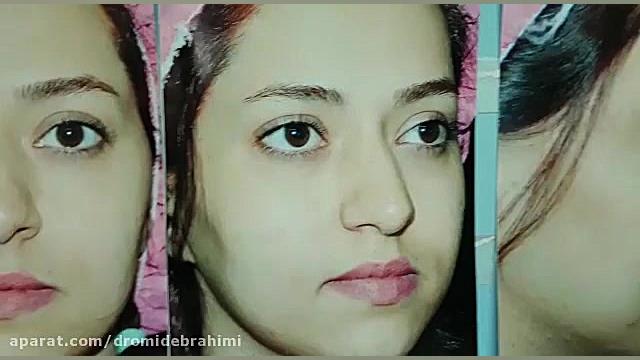 جراحی زیبایی بینی توسط بهترین جراح بینی طبیعی، دکتر امید ابراهیمی دکتر امید ابراهیمی