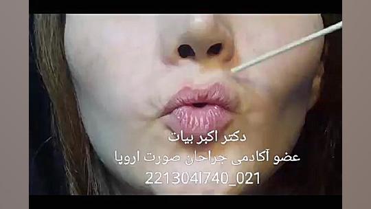 عوارض ناشی از نصب غیراستاندارد پروتز گونه در صورت TWA