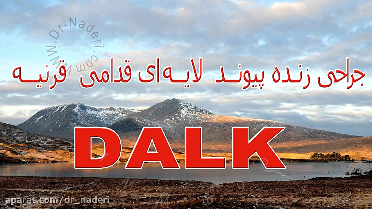 پیوند لایه ای قدامی قرنیه - مرکز چشم پزشکی دکتر علیرضا نادری مرکز چشم پزشکی دکتر علیرضا نادری www.dr-naderi.com