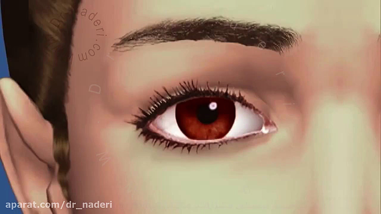آناتومی سیستم اشکی - مرکز چشم پزشکی دکتر علیرضا نادری مرکز چشم پزشکی دکتر علیرضا نادری www.dr-naderi.com