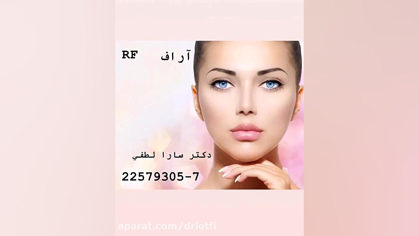 جوانسازی صورت با دستگاه آر اف دکتر سار ا لطفی