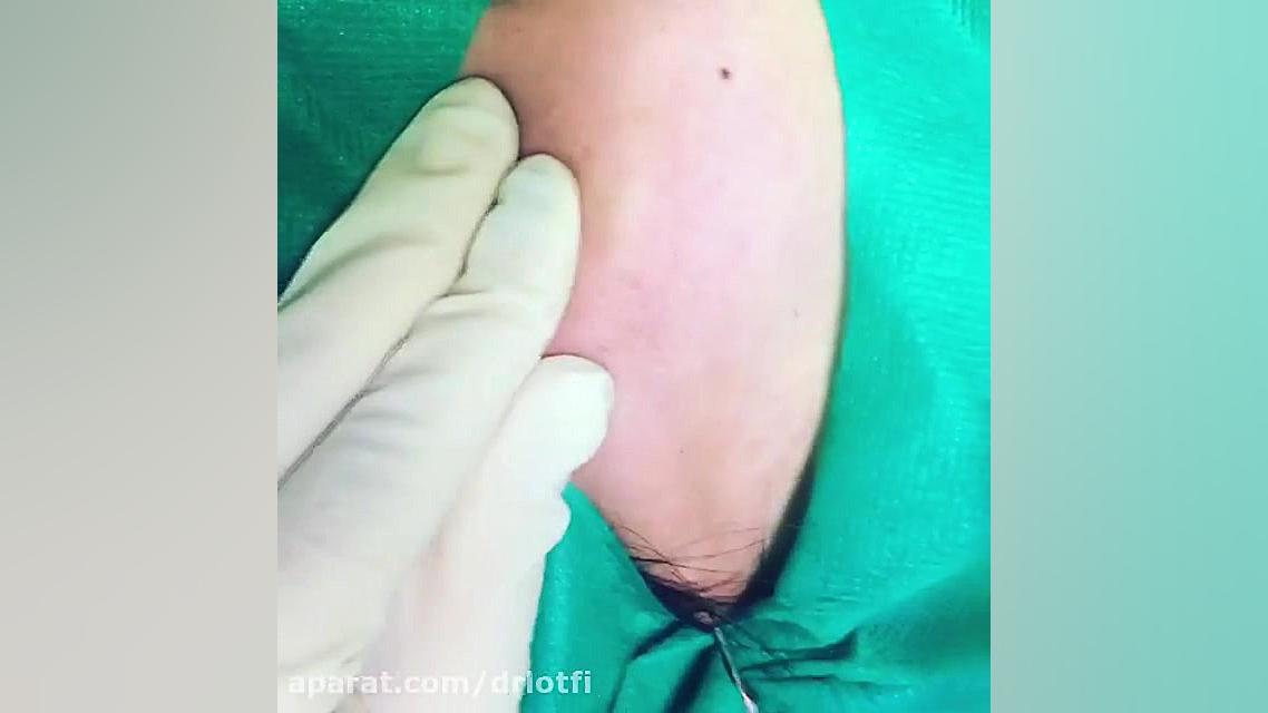 سابسیژن دکتر سار ا لطفی