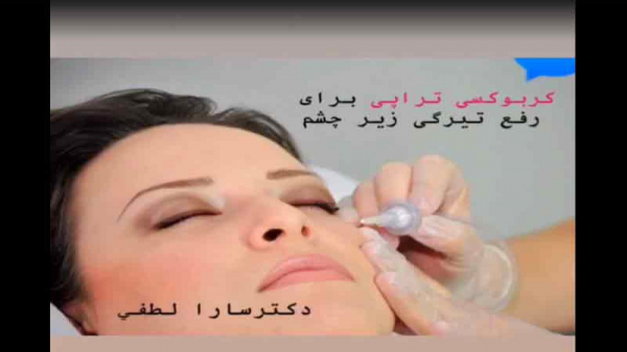 کربوکسی تراپی دکتر سار ا لطفی
