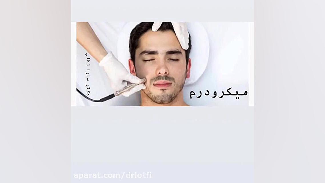 میکرودرم دکتر سار ا لطفی