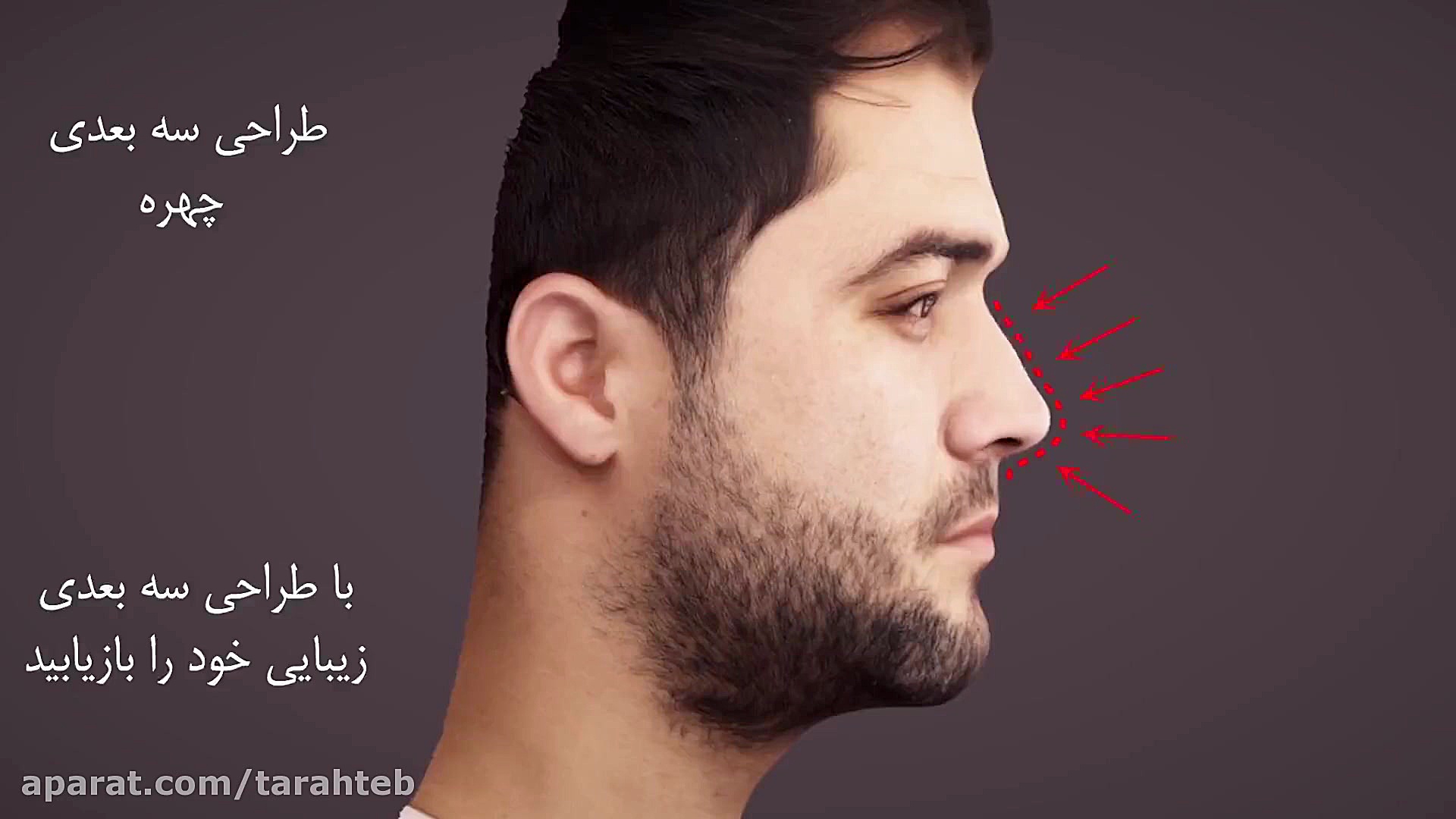 جراحی بینی مردانه مایکل جردن