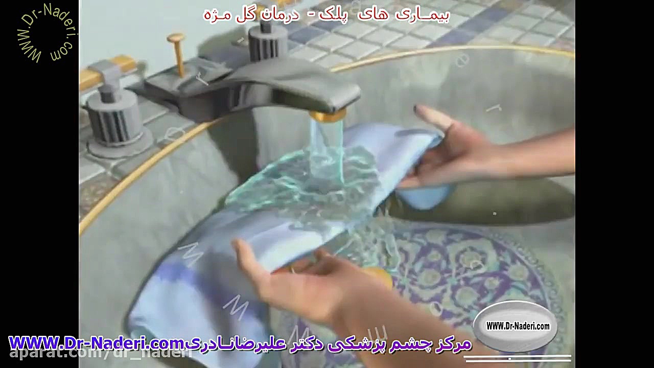 درمان گل مژه - مرکز چشم پزشکی دکتر علیرضا نادری مرکز چشم پزشکی دکتر علیرضا نادری www.dr-naderi.com