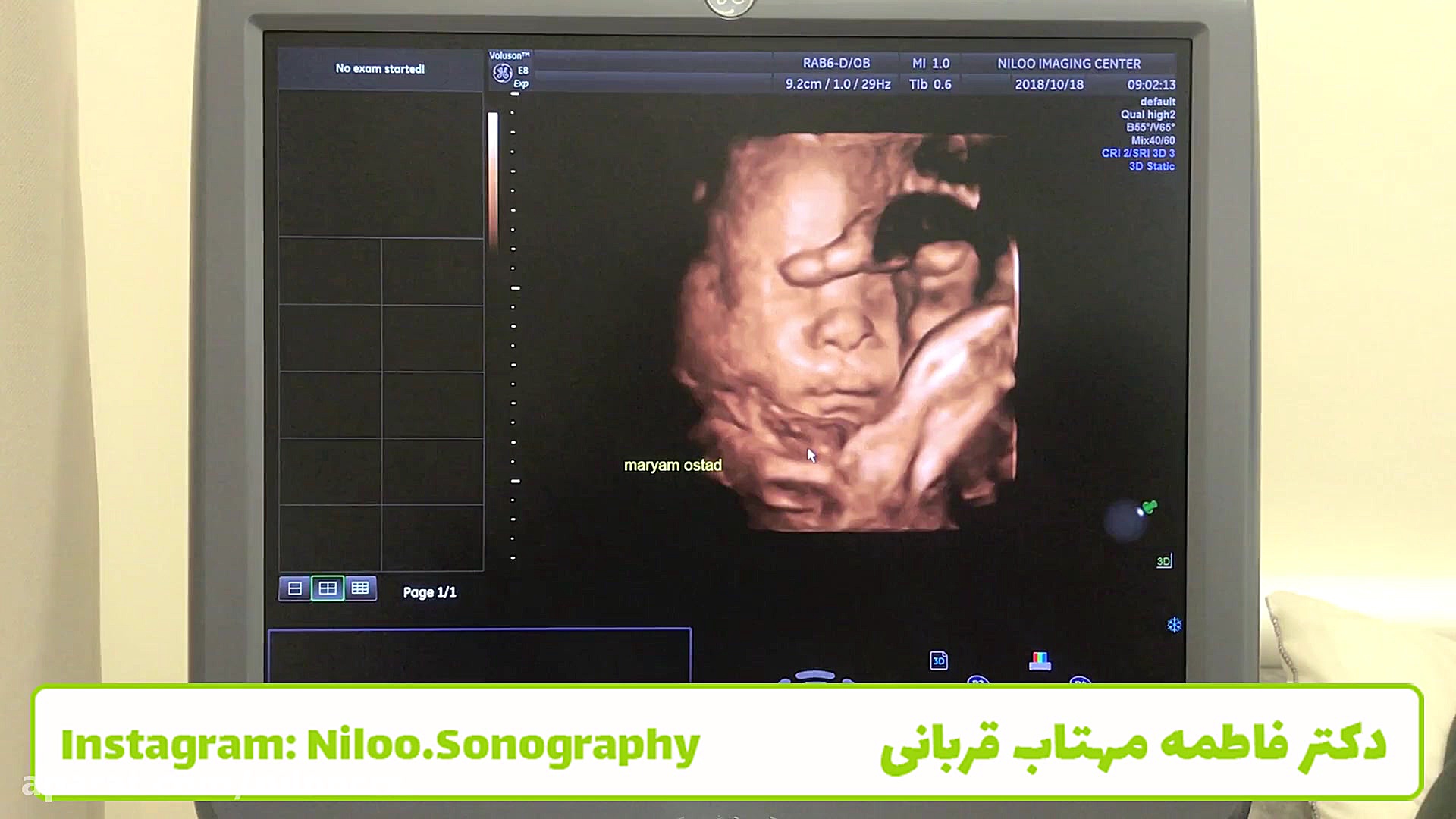 جنین می شنود سونوگرافی نیلو دکتر فاطمه مهتاب قربانی