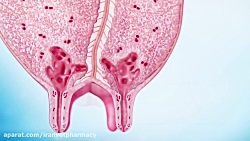 همه چیز در مورد ورم پستان گاو