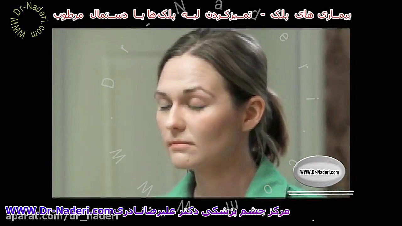 تمیز کردن لبه پلک ها با دستمال مرطوب - مرکز چشم پزشکی دکتر علیرضا نادری مرکز چشم پزشکی دکتر علیرضا نادری www.dr-naderi.com