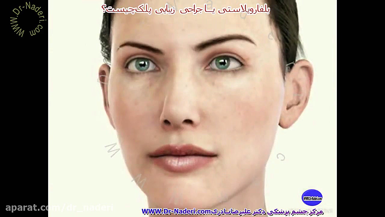 بلفاروپلاستی چیست؟مرکز چشم پزشکی دکتر علیرضا نادری مرکز چشم پزشکی دکتر علیرضا نادری www.dr-naderi.com