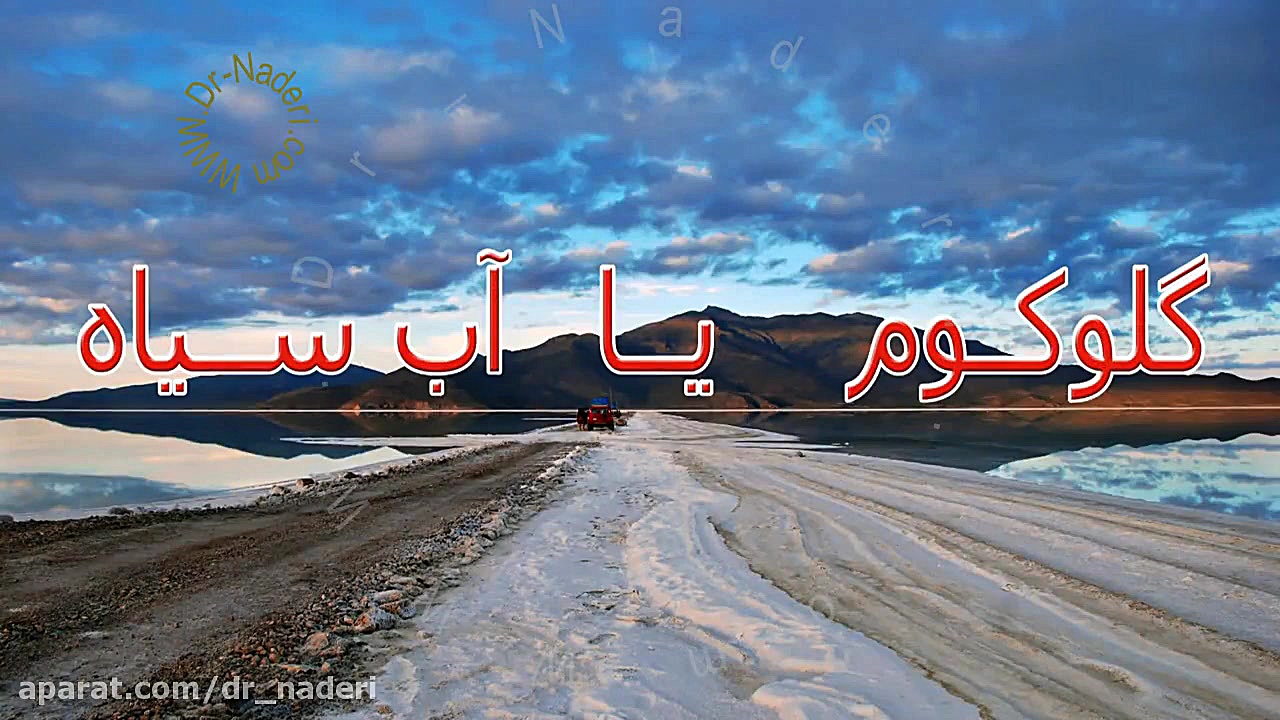 آشنایی با آب سیاه یا گلوکوم-مرکزچشم پزشکی دکتر علیرضا نادری مرکز چشم پزشکی دکتر علیرضا نادری www.dr-naderi.com