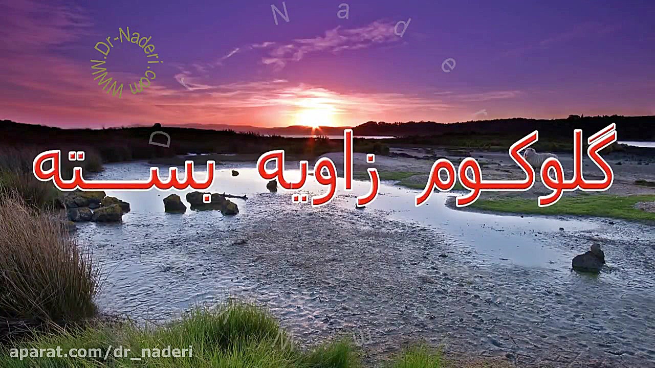 گلوکوم با زاویه تنگ - مرکز چشم پزشکی دکتر علیرضا نادری مرکز چشم پزشکی دکتر علیرضا نادری www.dr-naderi.com