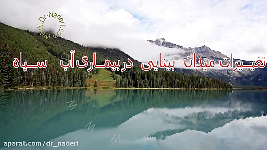 تغییرات میدان بینایی در گلوکوم - مرکز چشم پزشکی دکتر علیرضا نادری مرکز چشم پزشکی دکتر علیرضا نادری www.dr-naderi.com