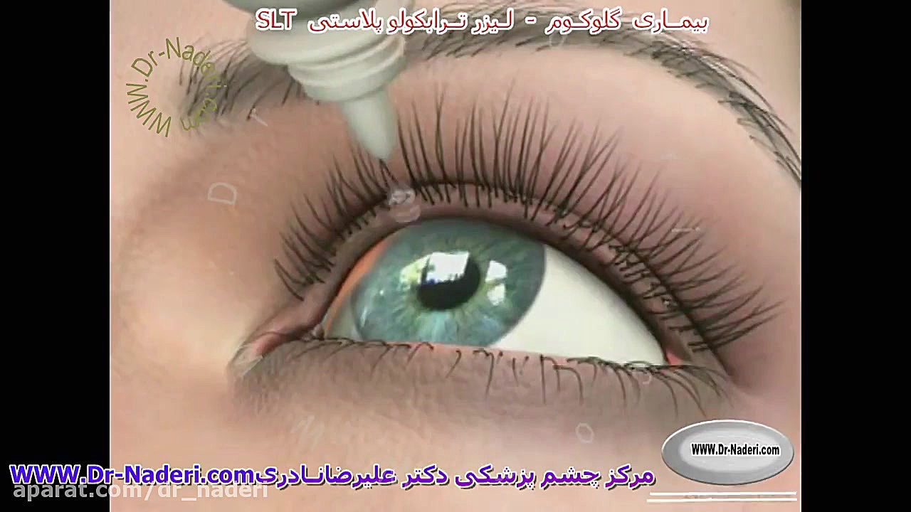 لیزر آرگون در بیماری آب سیاه - مرکز چشم پزشکی دکتر علیرضا نادری مرکز چشم پزشکی دکتر علیرضا نادری www.dr-naderi.com