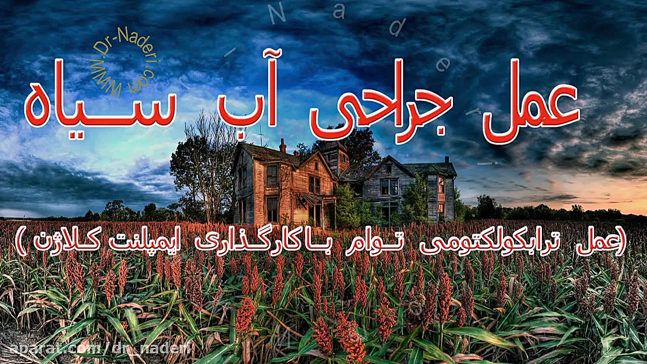 جراحی آب سیاه و کارگذاری ایمپلنت - مرکز چشم پزشکی دکتر علیرضا نادری مرکز چشم پزشکی دکتر علیرضا نادری www.dr-naderi.com