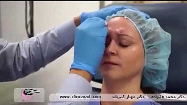 تزریق ژل و بوتاکس و چربی سیستم ارزیابی هیستوترمیک