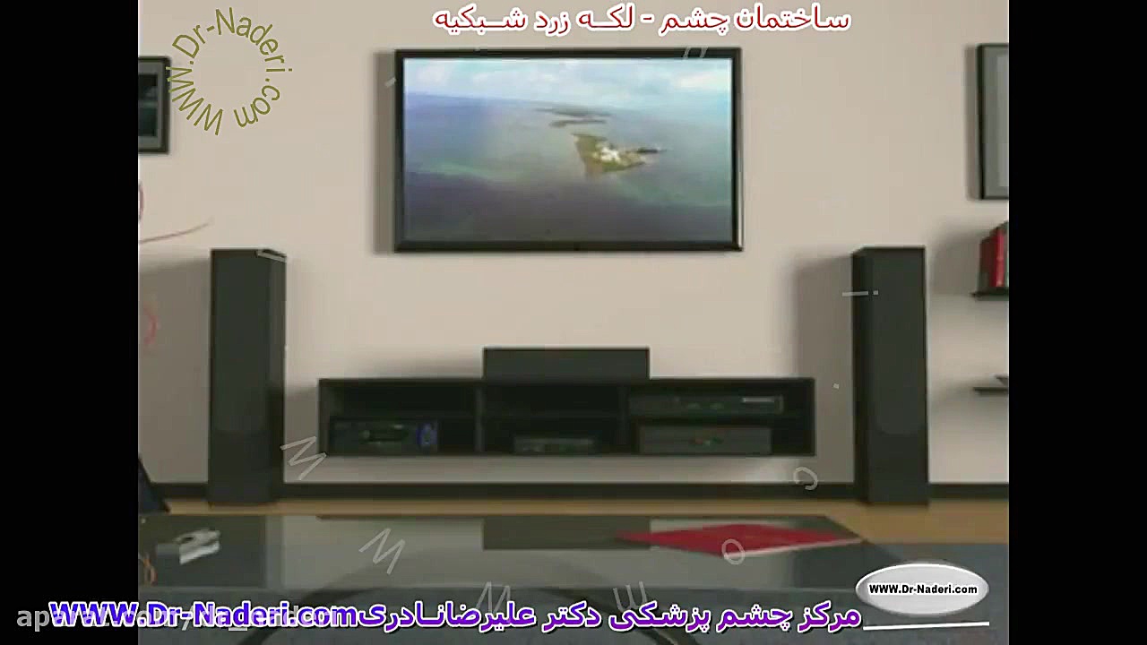 لکه زرد شبکیه چشم یا ماکولا - مرکز چشم پزشکی دکتر علیرضا نادری مرکز چشم پزشکی دکتر علیرضا نادری www.dr-naderi.com