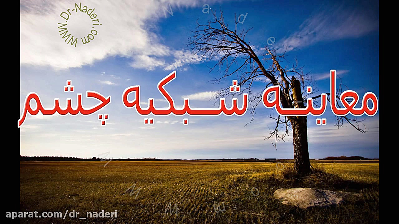 معاینه شبکیه - مرکزچشم پزشکی دکتر علیرضا نادری مرکز چشم پزشکی دکتر علیرضا نادری www.dr-naderi.com