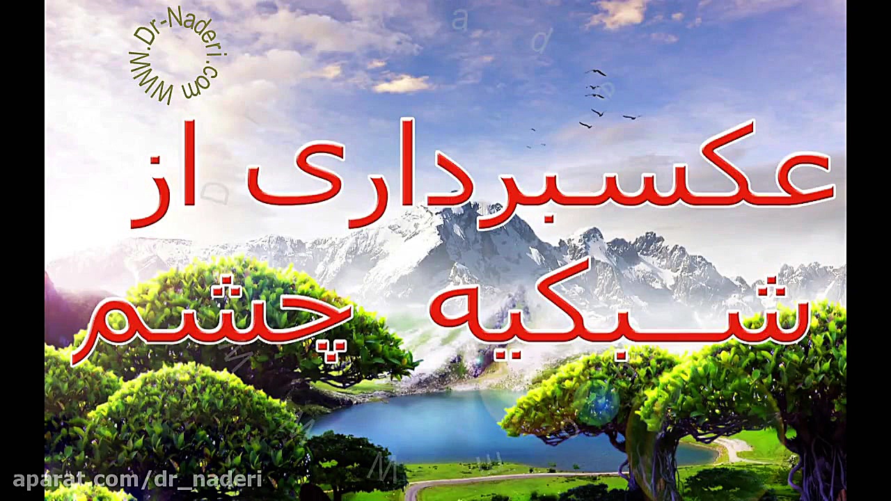 آنژیوگرافی شبکیه - مرکز چشم پزشکی دکتر علیرضا نادری مرکز چشم پزشکی دکتر علیرضا نادری www.dr-naderi.com