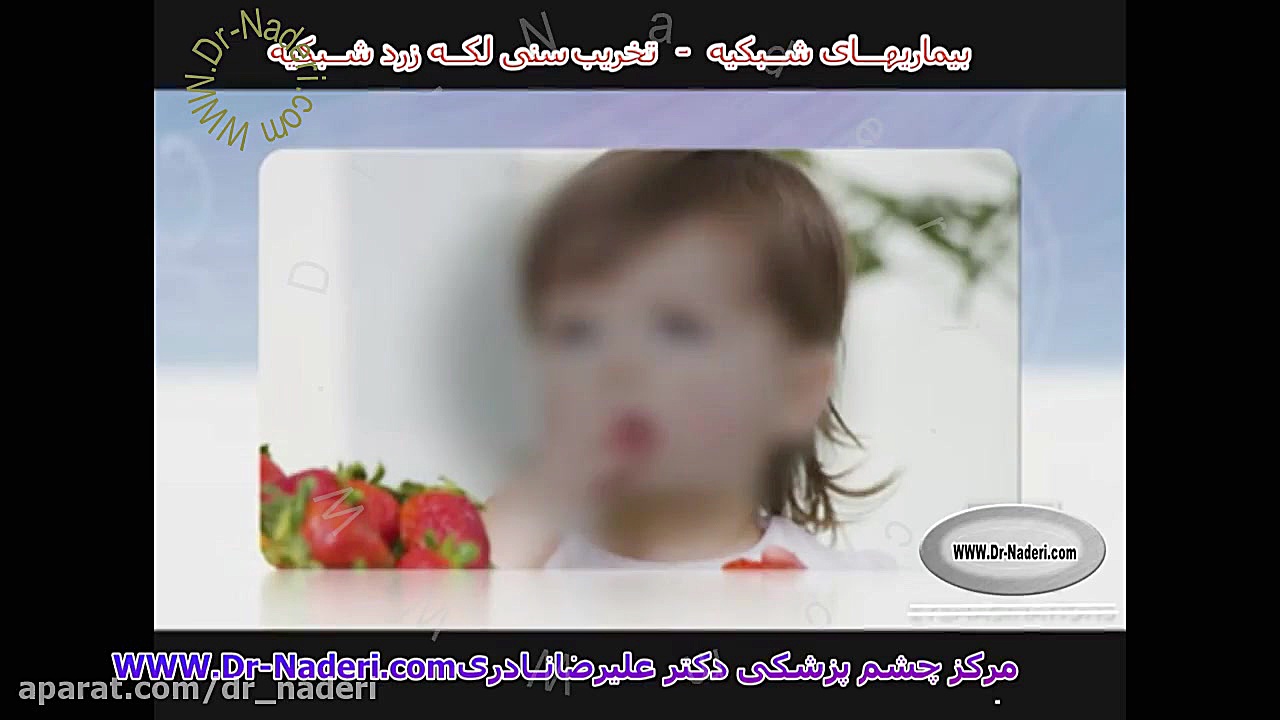 تخریب لکه زرد شبکیه ناشی ازسن-مرکزچشم پزشکی دکترنادری مرکز چشم پزشکی دکتر علیرضا نادری www.dr-naderi.com