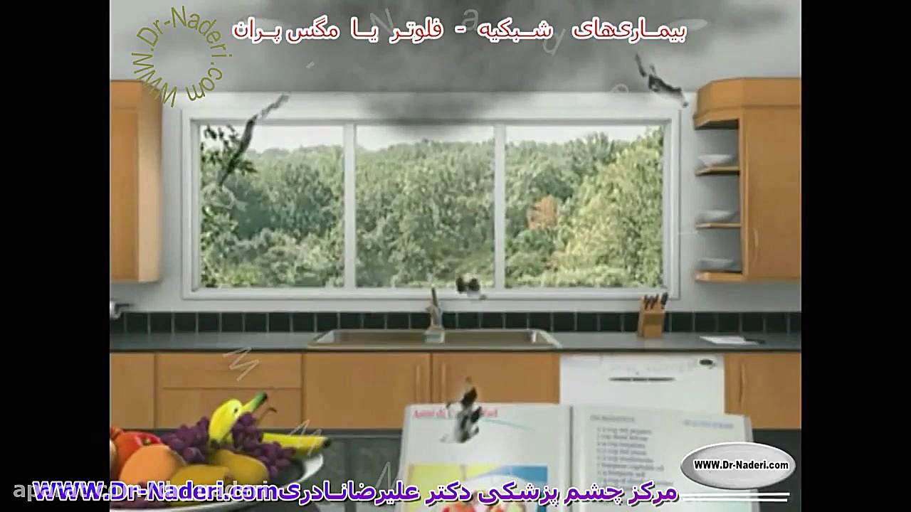 مگس پران یا فلوتر -مرکز چشم پزشکی دکتر علیرضا نادری مرکز چشم پزشکی دکتر علیرضا نادری www.dr-naderi.com