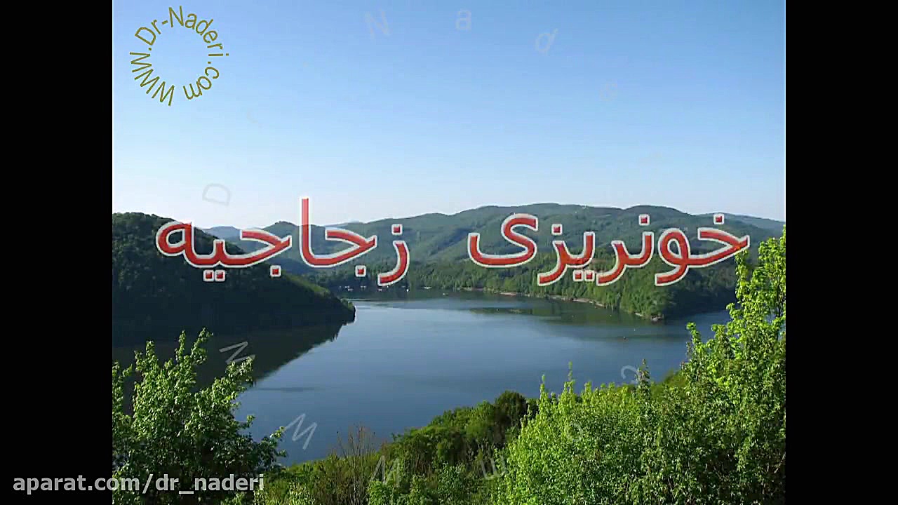 خونریزی زجاجیه-مرکز چشم پزشکی دکتر علیرضا نادری مرکز چشم پزشکی دکتر علیرضا نادری www.dr-naderi.com