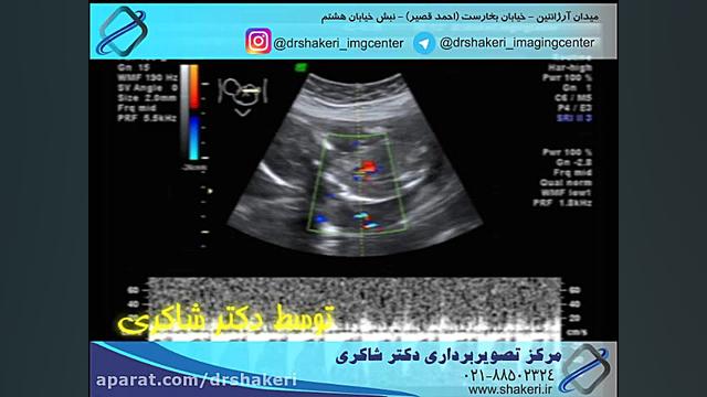 سونوگرافی جنین / مرکز تصویربرداری دیجیتال دکتر شاکری بررسی لک صورت