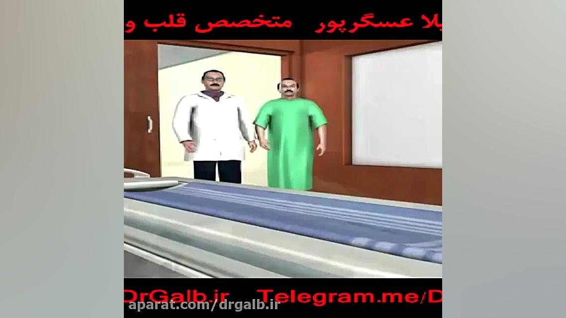 سی تی آنژیوگرافی کاشت ابرو