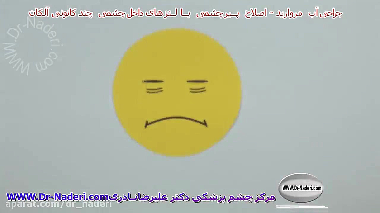 لنزهای سه کانونی آلکان - مرکز چشم پزشکی دکتر علیرضا نادری مرکز چشم پزشکی دکتر علیرضا نادری www.dr-naderi.com