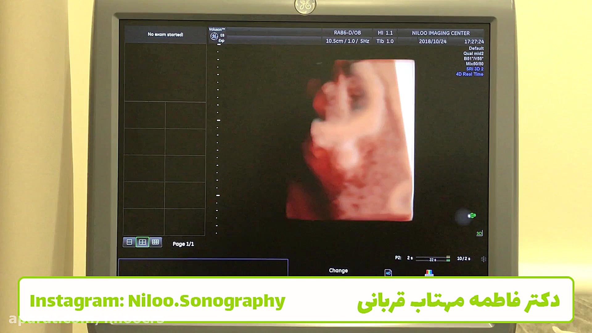 مشاهده اندام های جنین سونوگرافی نیلو دکتر فاطمه مهتاب قربانی