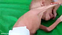 فاجعه انسانی یمن