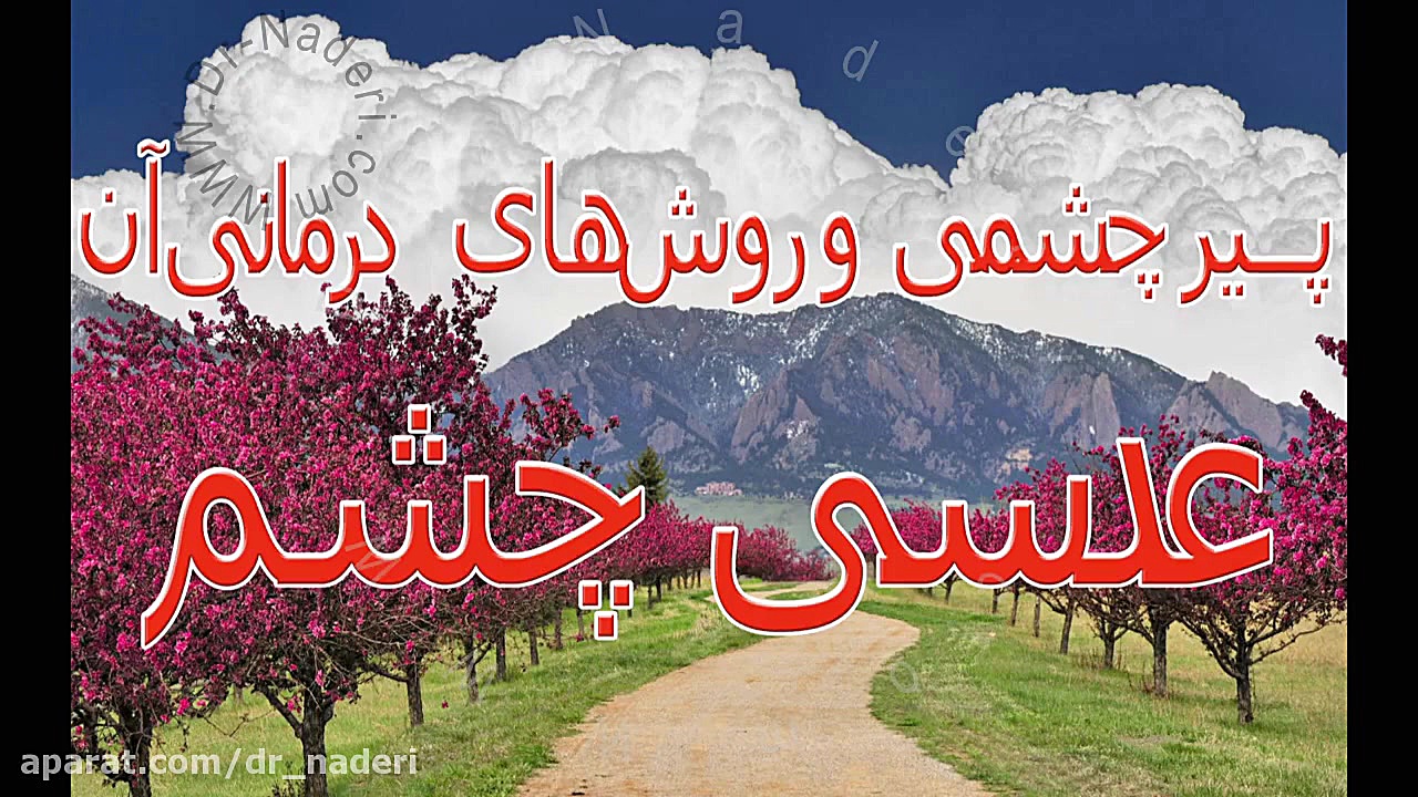 عدسی-ساختمان چشم-مرکز چشم پزشکی دکتر علیرضا نادری مرکز چشم پزشکی دکتر علیرضا نادری www.dr-naderi.com