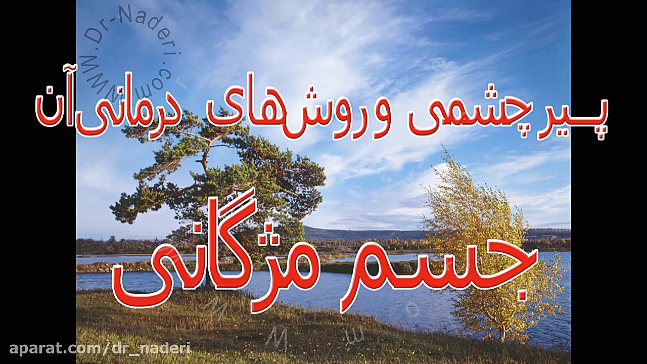 جسم مژگانی چشم - مرکزچشم پزشکی دکتر علیرضا نادری مرکز چشم پزشکی دکتر علیرضا نادری www.dr-naderi.com
