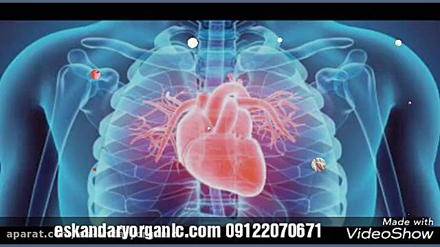 درمان بیماری قلب و عروق با طب سنتی (بنیانگذار طب جامع در ایران)حکیم اسکندری ترمیم لبخند لثه‌ای