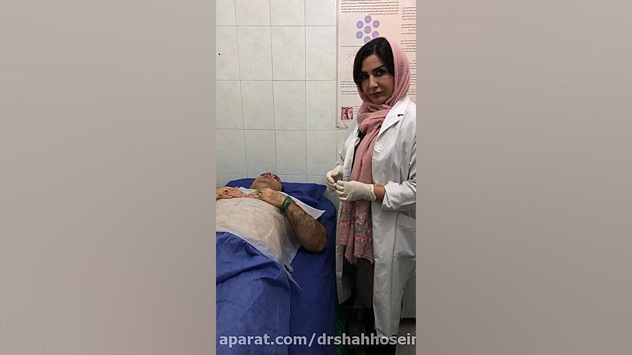 درمان فلج بلز با طب سوزنی با دکتر زهرا شاه حسینی قسمت 1 درمان سلولیت