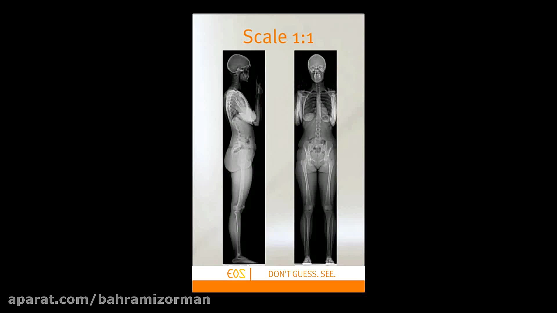 عملكر Eos Imaging مهران مدیری