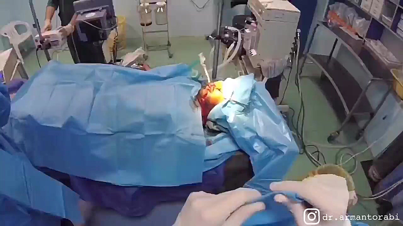عمل جراحی اورژانسی در مشهد دکتر آرمان ترابی زاده متخصص جراحی دهان، فک و صورت