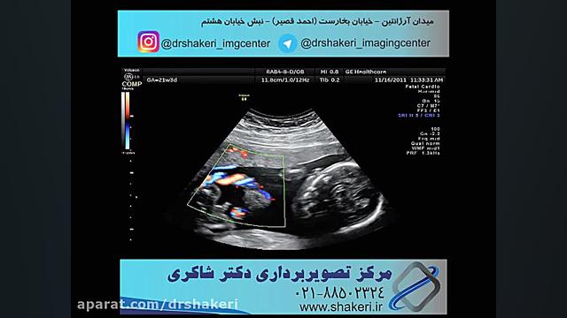 سونوگرافی کالر داپلر / مرکز تصویربرداری دیجیتال دکتر شاکری ترمیم زیبایی دندان